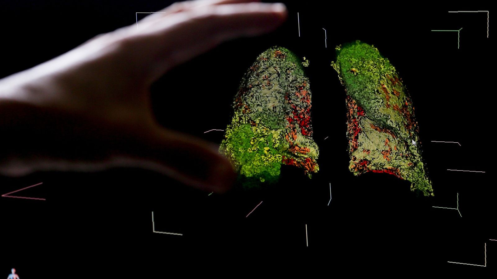 Salud en tiempos de COVID 19